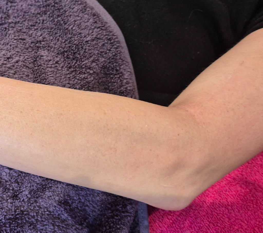 Waxing After Treatment - Silky Smooth Skin